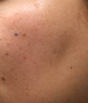 ipl (5)