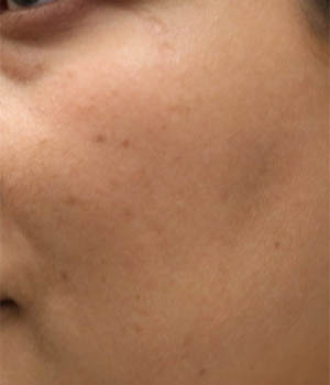 ipl (6)