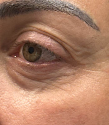 lesion2 (2)