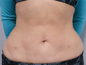 _0001_after M8 stomach.jpg