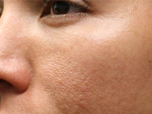 _0002_patient 8 before morpheus – Copy.PNG