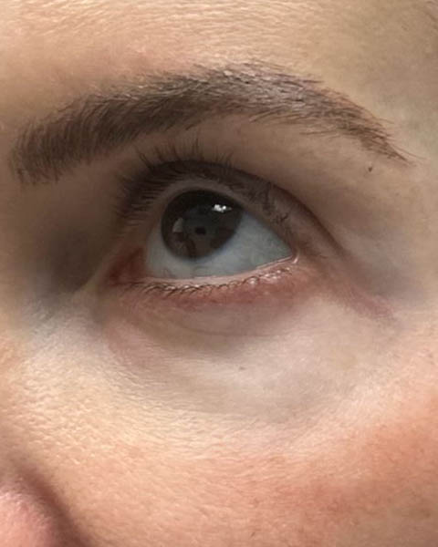 before and after surgery pictures | Top Miami Surgeon Gregory D. Lewen, MD