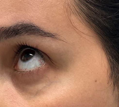 before and after surgery pictures | Top Miami Surgeon Gregory D. Lewen, MD