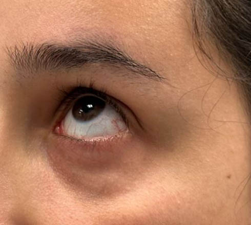 before and after surgery pictures | Top Miami Surgeon Gregory D. Lewen, MD