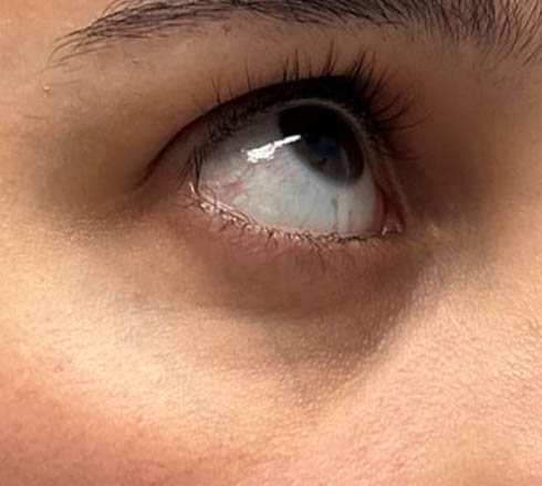 before and after surgery pictures | Top Miami Surgeon Gregory D. Lewen, MD