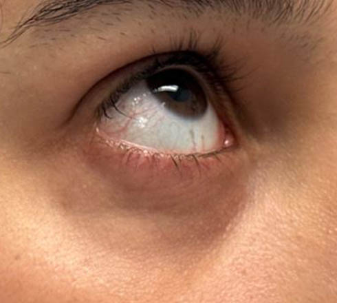 before and after surgery pictures | Top Miami Surgeon Gregory D. Lewen, MD