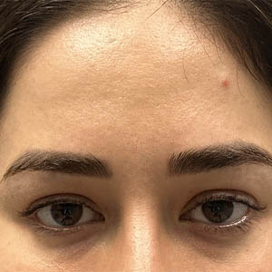 before and after surgery pictures | Top Miami Surgeon Gregory D. Lewen, MD
