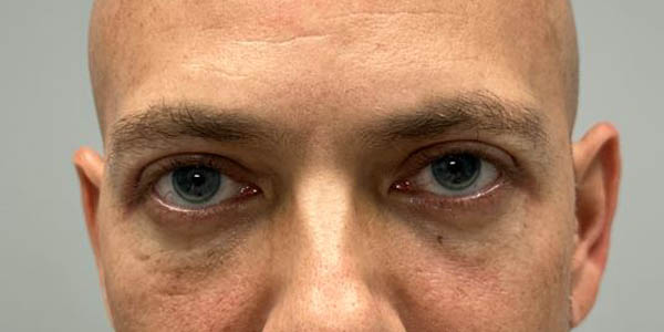 _0003_PT 44 after — eyes only.JPG
