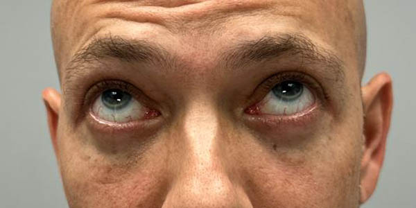 _0005_PT 44 after looking up– eyes only.JPG