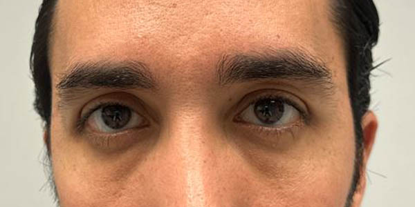 _0011_PT 46 after — eyes only.JPG