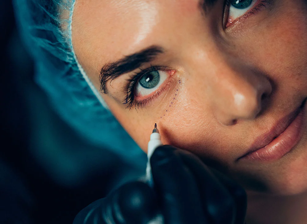 lower eyelid-what