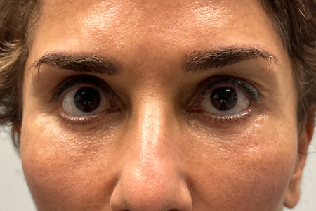 PATIENT 3 SIDE BY SIDE.jpg