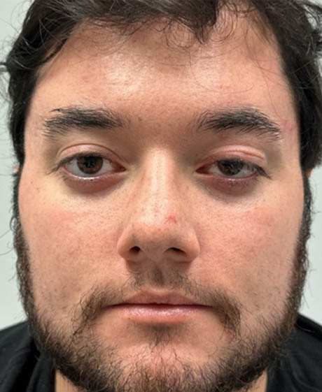 1_0009_FULL FACE AFTER M8 .png